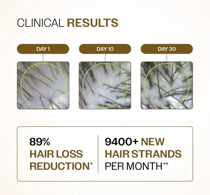 Neem Villa Advanced Hair Growth Serum (30ml)