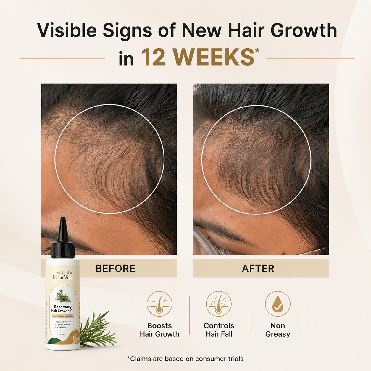 Neem Villa Rosemary Hair Growth Oil (100ml)