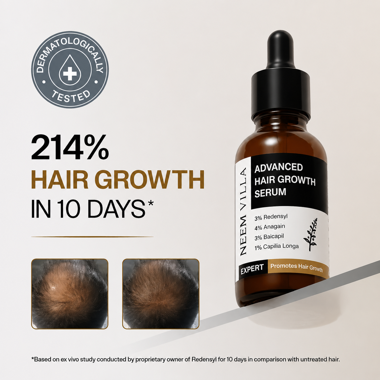 Neem Villa Advanced Hair Growth Serum (30ml)